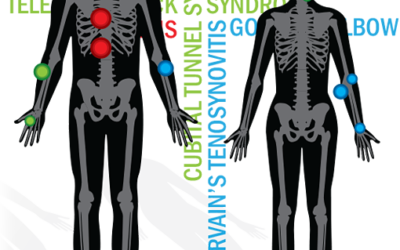 Ergonomics Month: Spooky, Scary, (damage to your) Skeletons